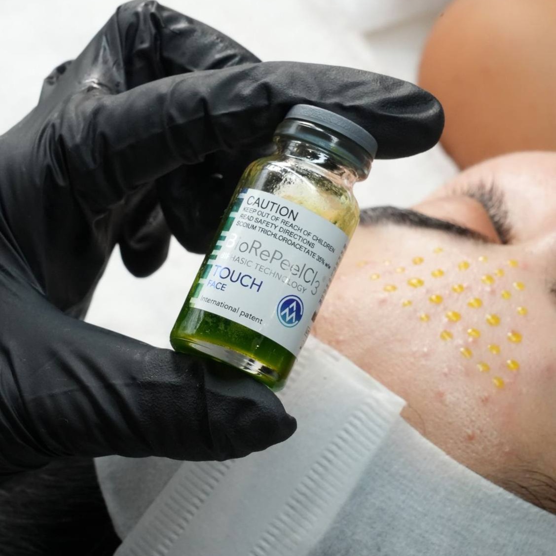 BioRePeel Treatments at Beauty Lab by Irina in Plano, TX