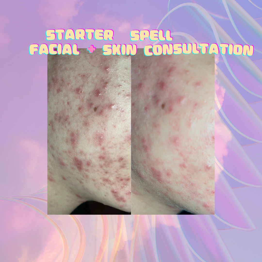 ✨Starter Spell: Facial +Consult✨