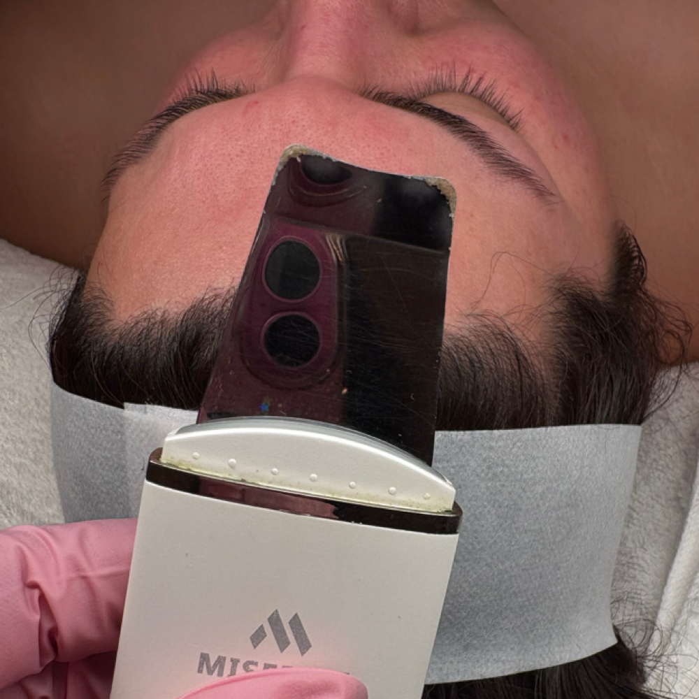 Deep Cleansing Acne Facial at Euphoria Skin in Chandler, AZ