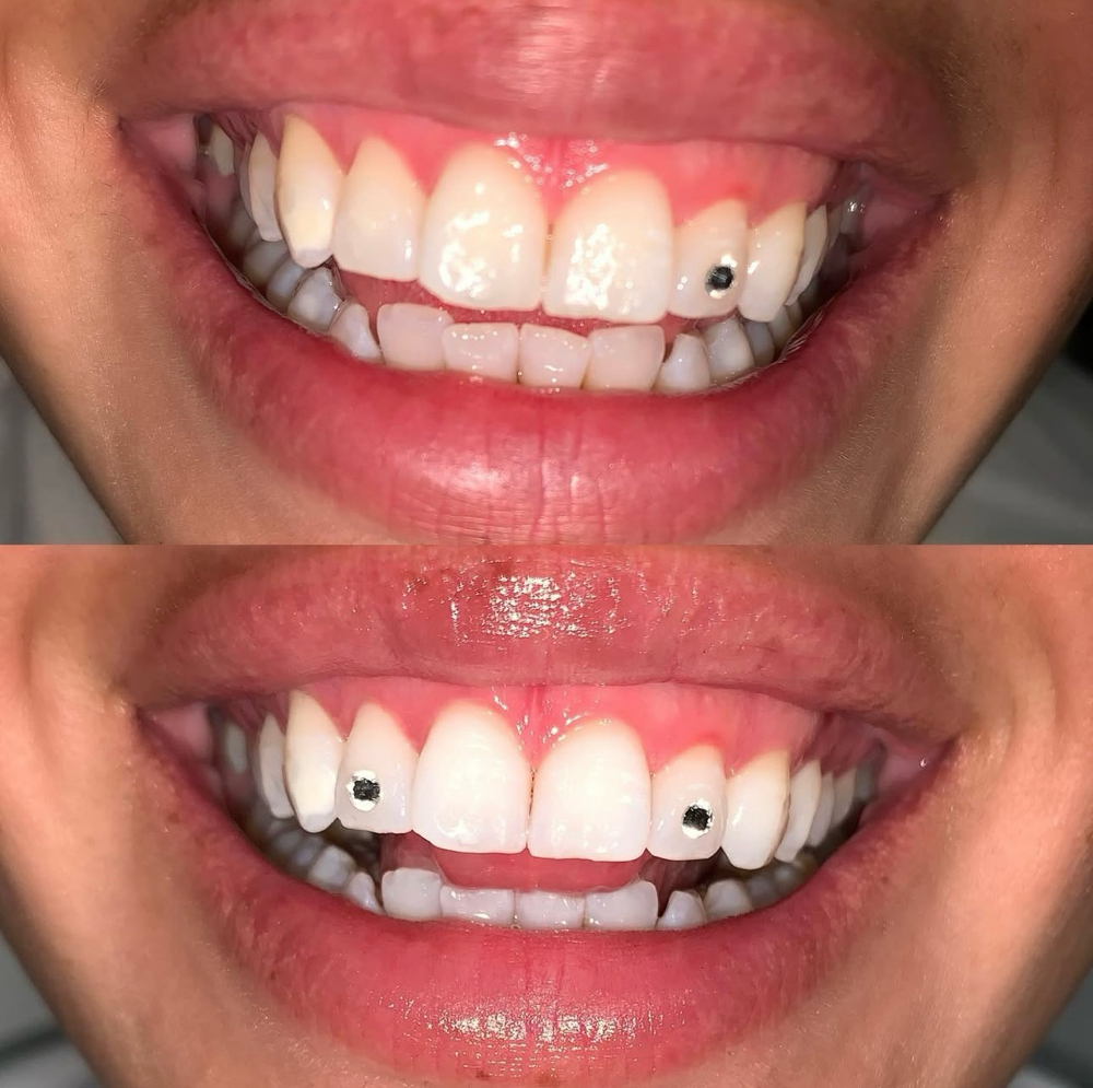 CRYSTAL [CO-PAIR]™