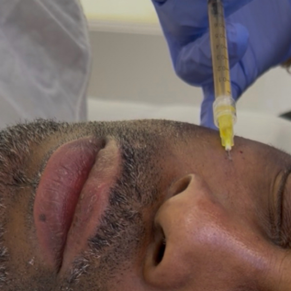 PRP Under Eyes at Zen Essence Spa & Wellness in Brooklyn, NY