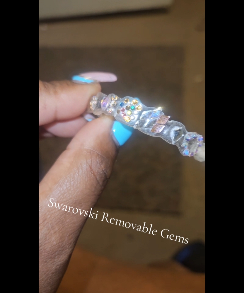 Removable Tooth Gems