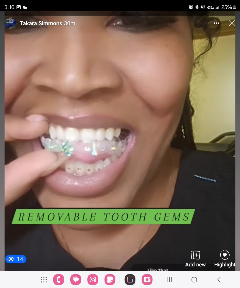 Removable Tooth Gems