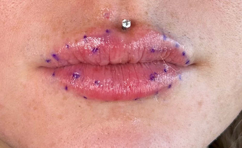 FIRST LIP SESSION (+Consultation)