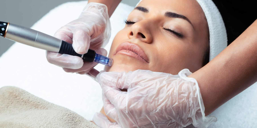 Microneedling Facial