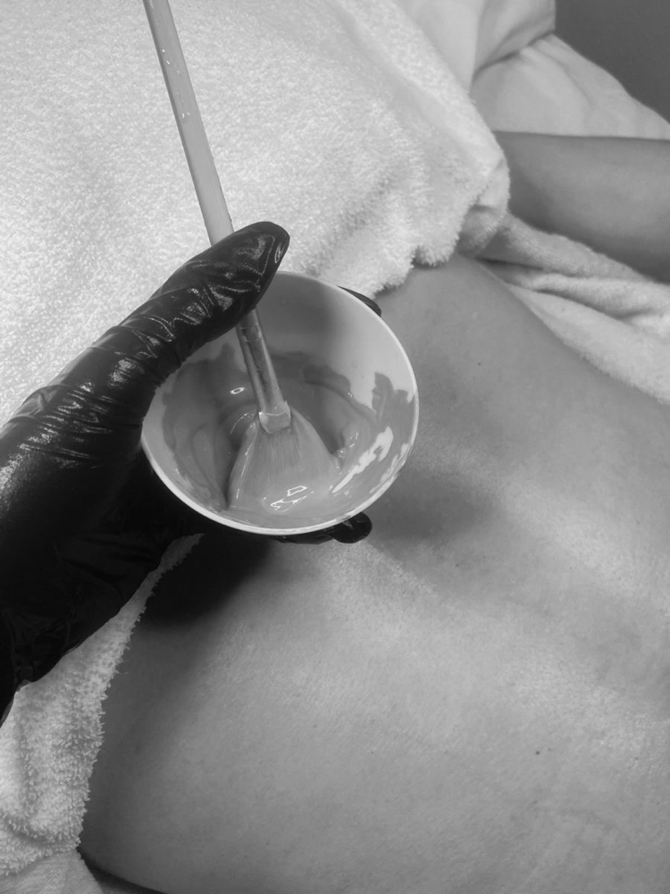 Back Facial at Kayelee Beauty Essentials in Salem, OR