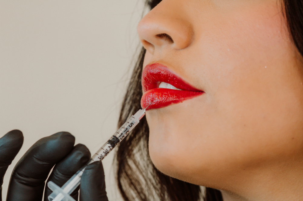 Lip Filler at Belleza Divina Aesthetics in Guymon, OK