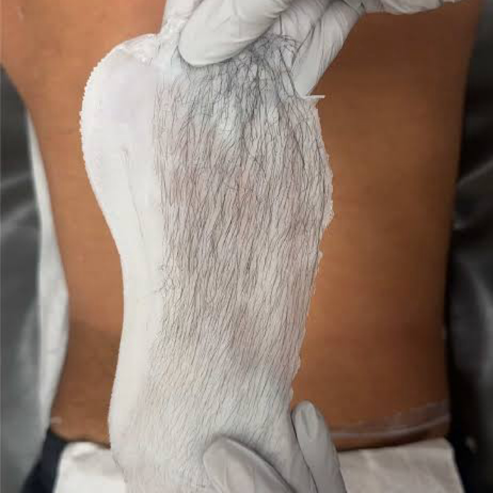 Back Wax at Flawless Beauty by Sierra in Roseville, CA