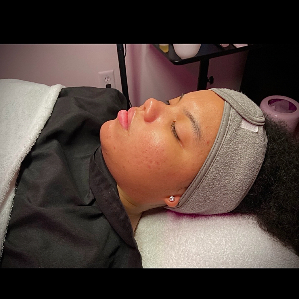 Clear Skin Facial at EstibyJos in Wauwatosa, WI
