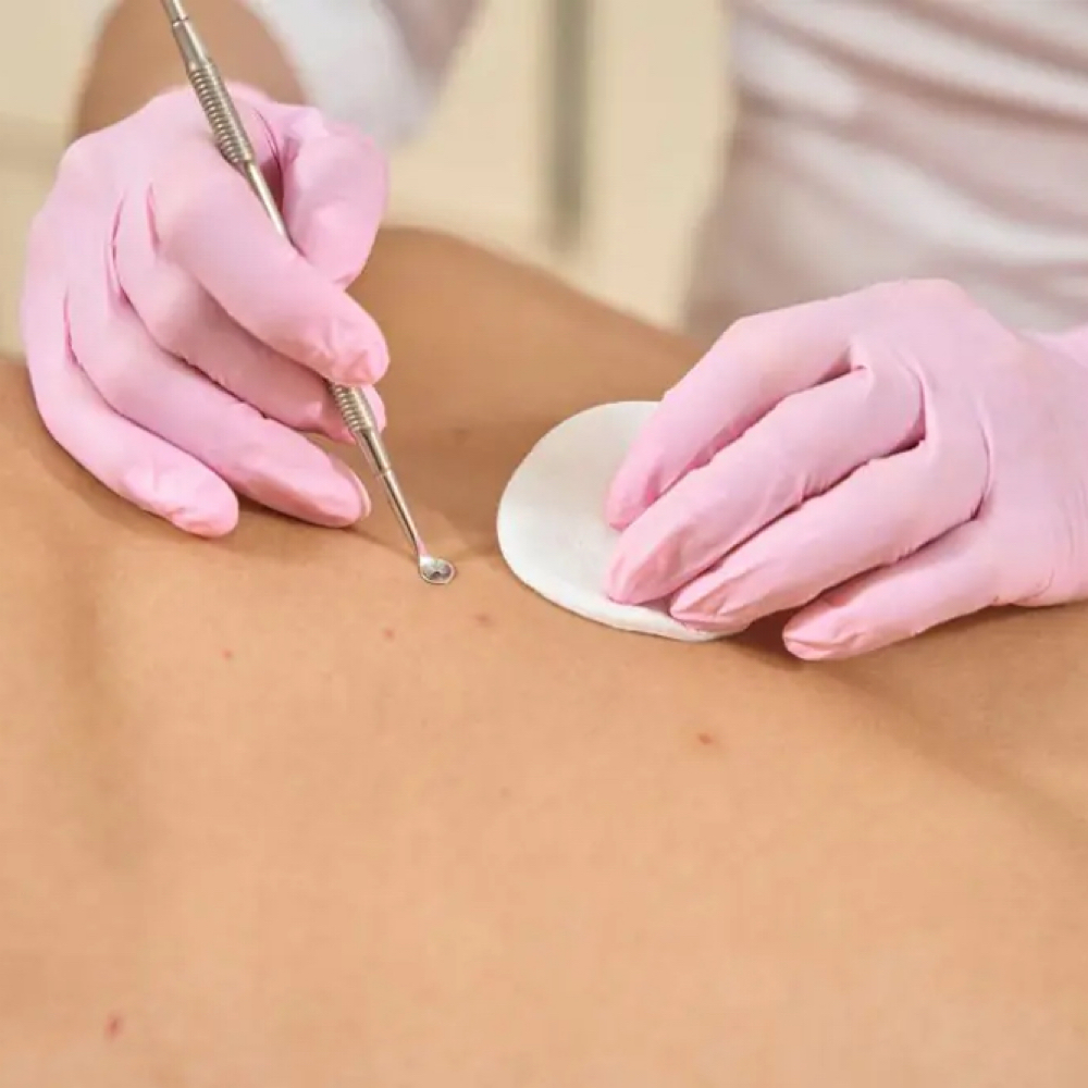 Back Facial at Luxe Beauty Lounge in Jasper, TX