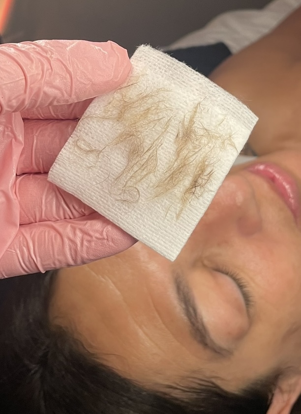 Express Dermaplane Facial at Golden Skin Bar in Mesa, AZ