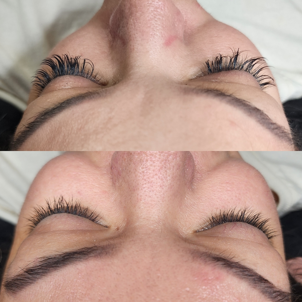 Lash Removal