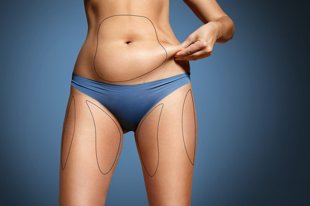 Body Contouring (Single Area )
