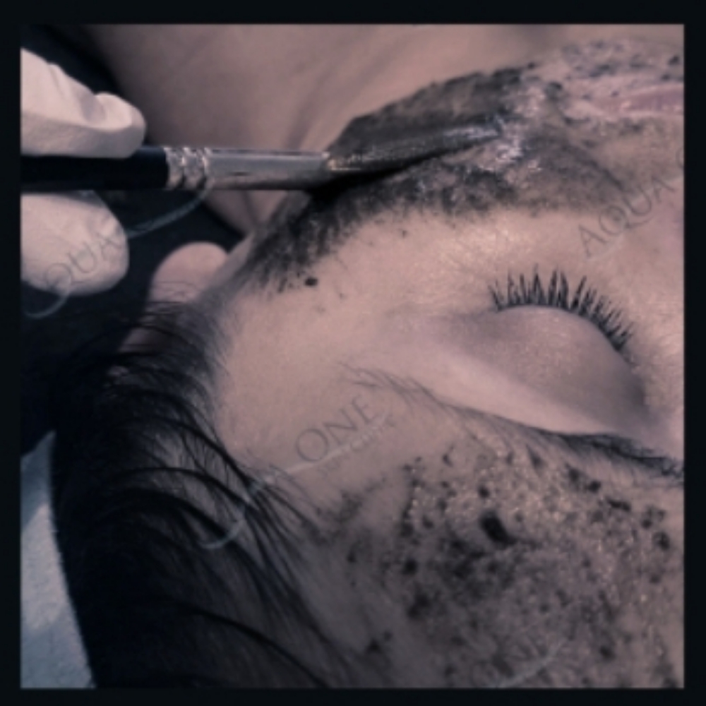 BioMicroneedling Level 3 at Aqua One Skin Clinic in Jasper, IN