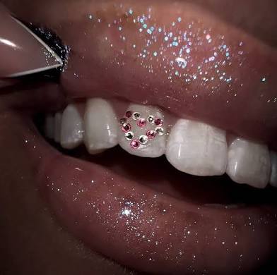 Tooth Gems