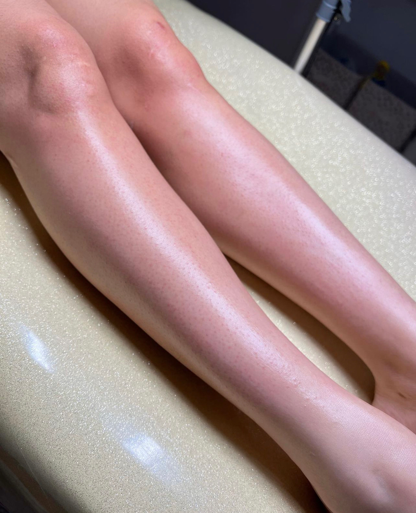 Lower Legs