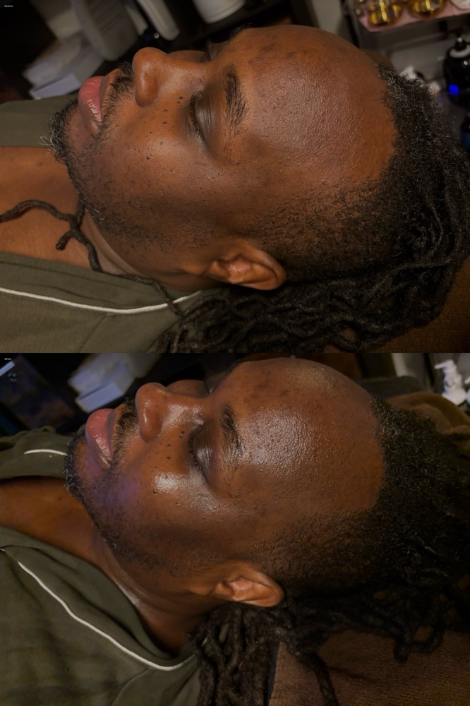 Deluxe Corrective Facial