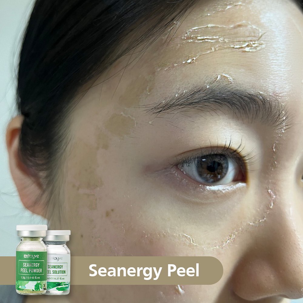 SEANERGY Peel