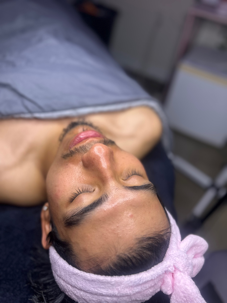 Dermaplane Facial