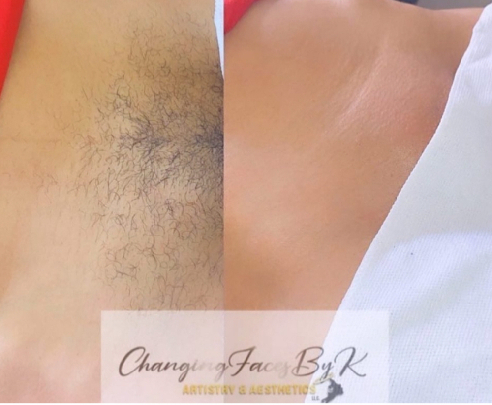 Returning Client Brazilian Wax