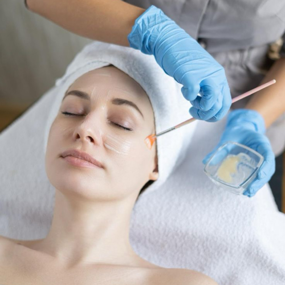 Chemical Peel at Vanessa Yarce in Miami, FL