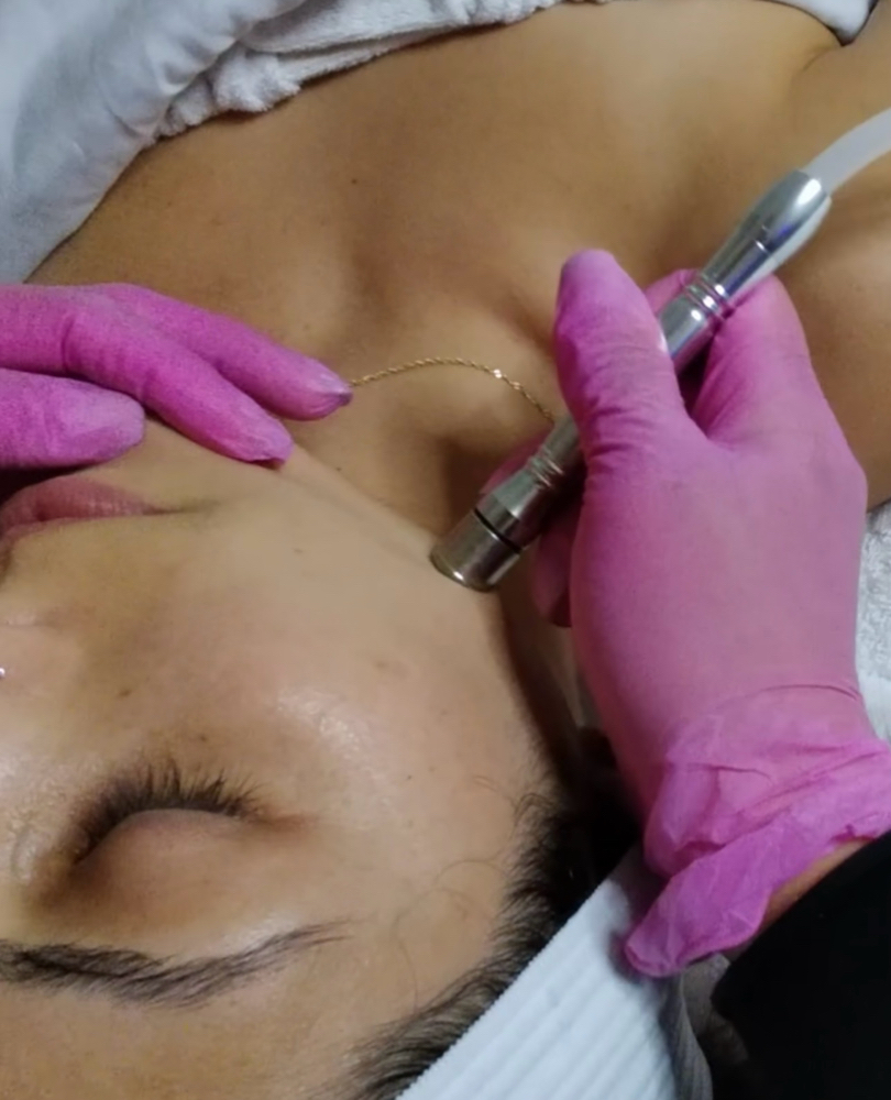 MICRODERMABRASION ELITE