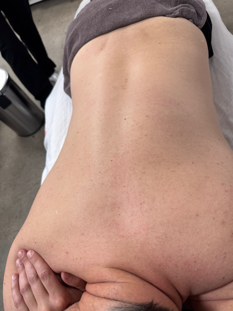 Oxygen Back Facial