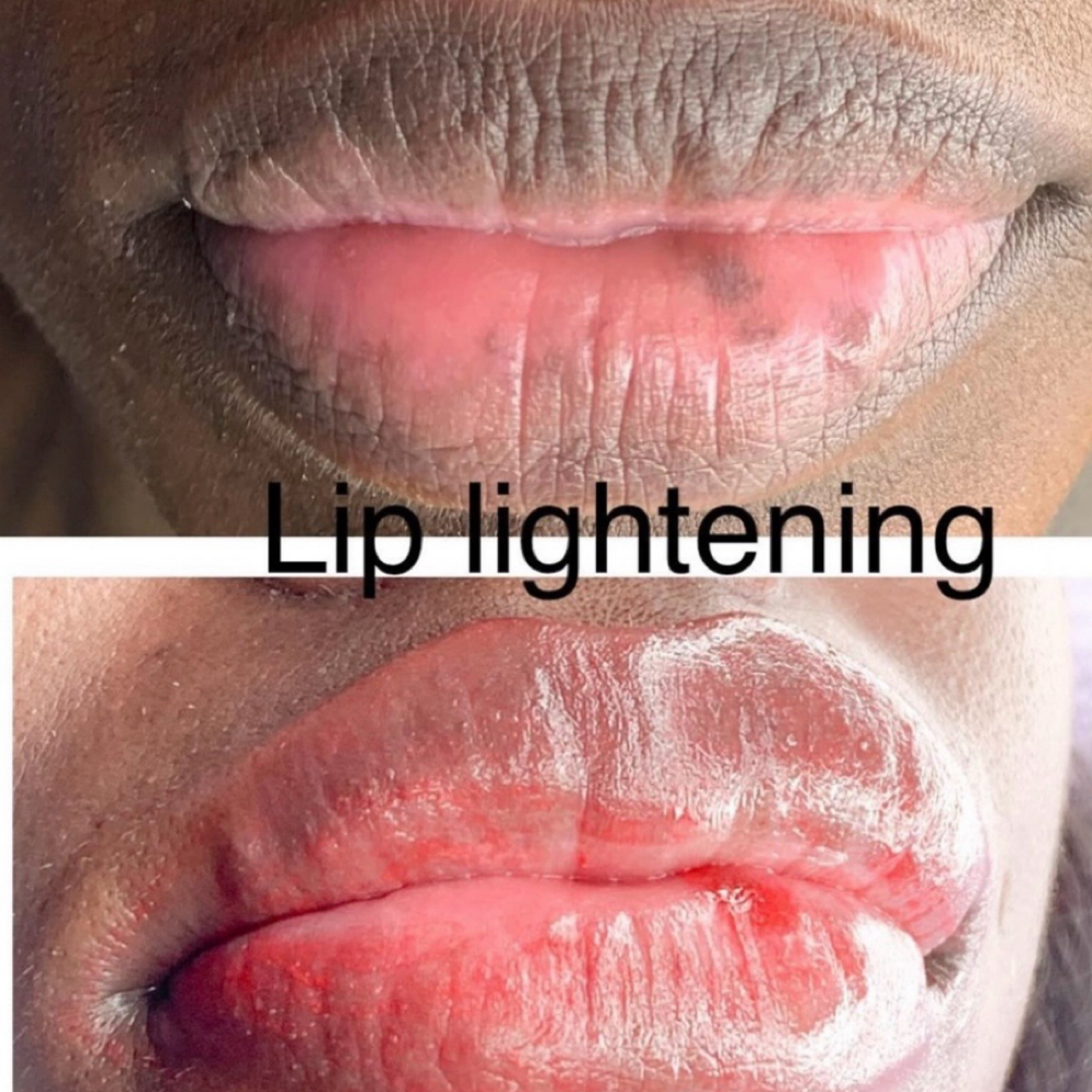 LIP LIGHTENING at GLAM STARR in Roswell, GA