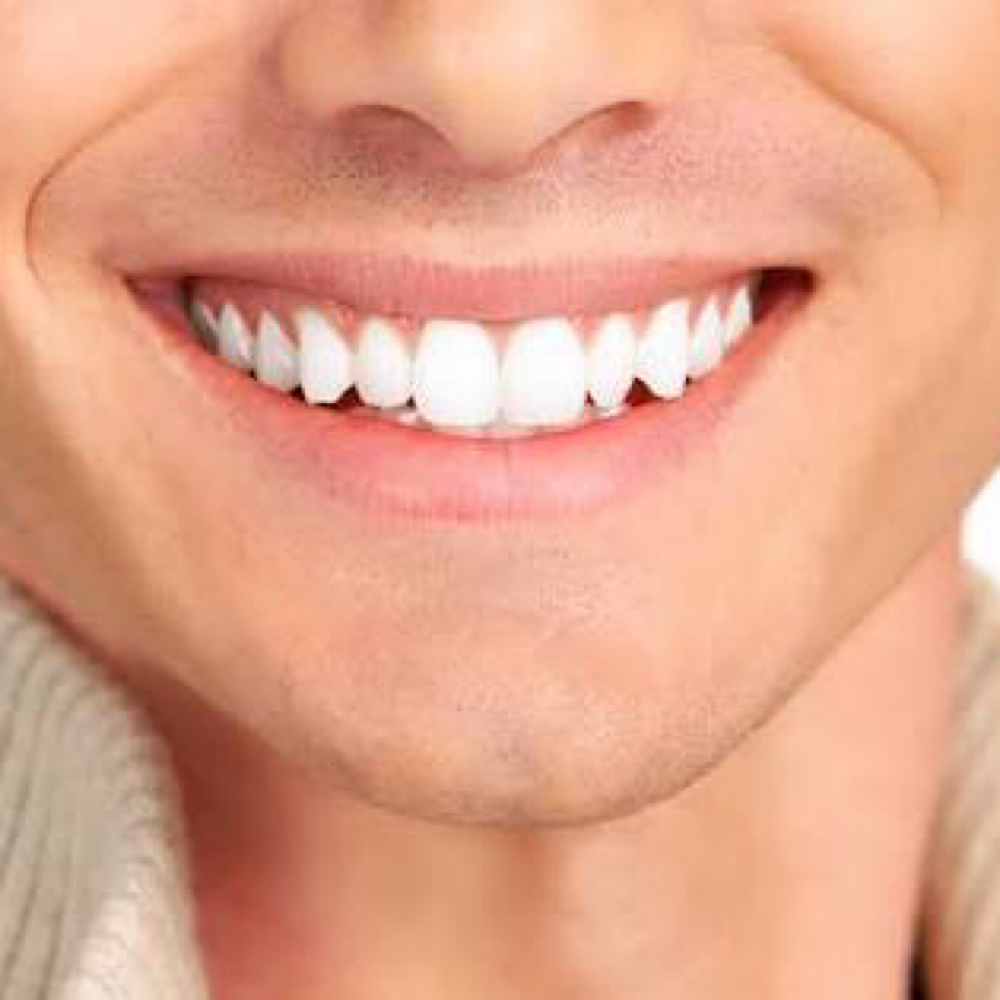 Light Touch-Up at Enthused Smiles in Montclair, NJ