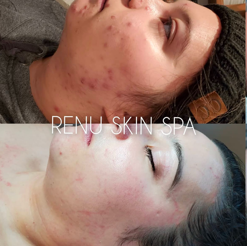Skin Consultation