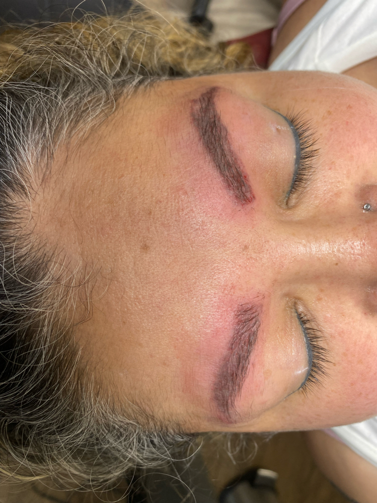 Saline Removal