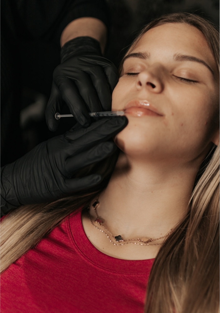 Facial Fillers