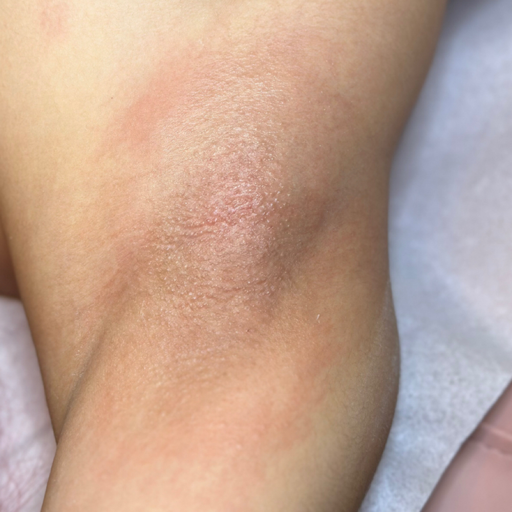 Under Arm Wax at Darisa Beauty & Care in Flagstaff, AZ