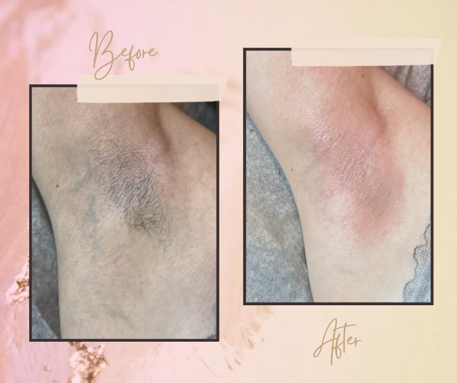 Under Arm Wax