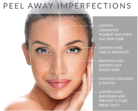 The Perfect Derma Peel