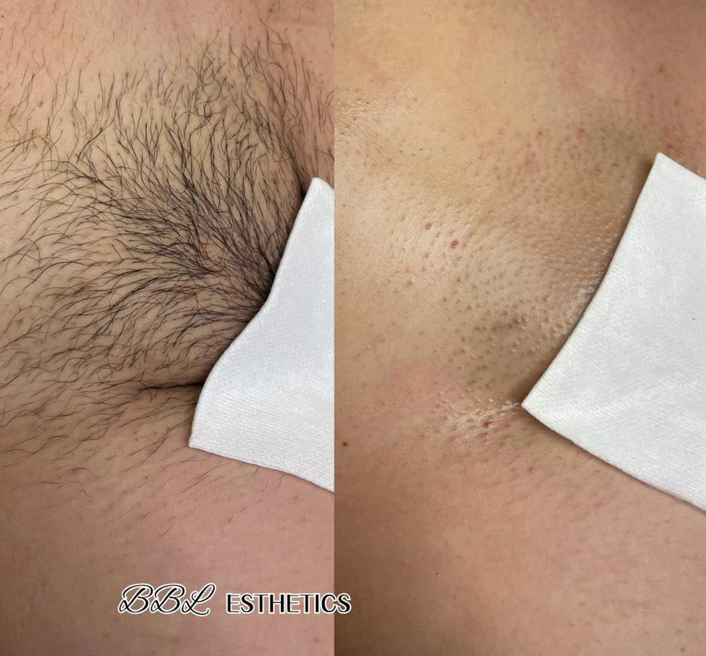 FULL BRAZILIAN WAX