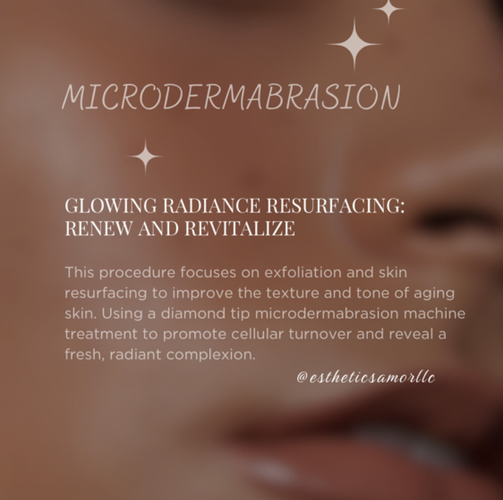 Microdermabrasion treatment at Esthetics Amor LLC in Wellington, FL