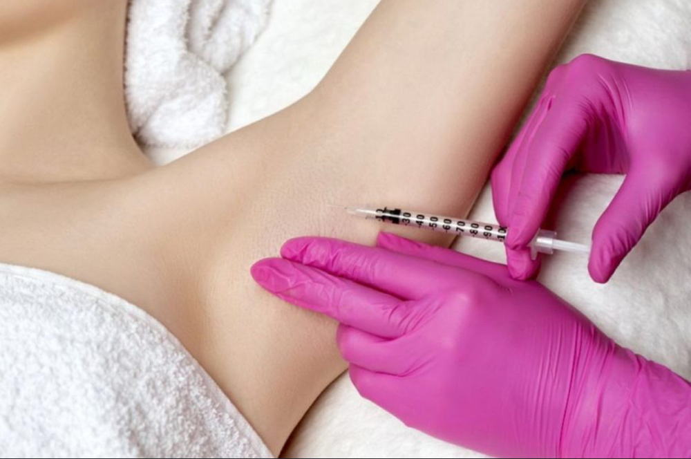 Botox (Underarms, Hands, Feet)