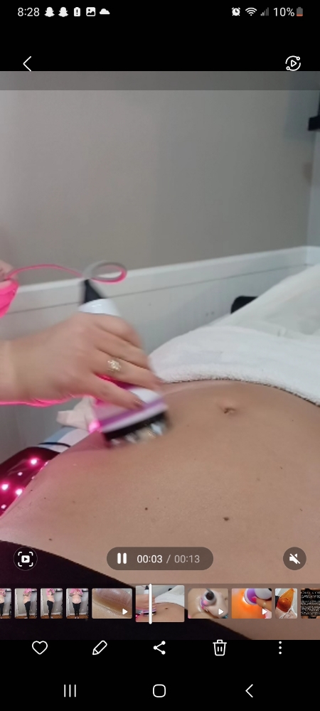 Cavitation and laser lipo combo