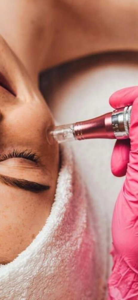 Microneedling