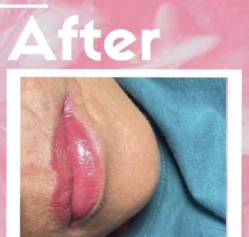 Permanent Lip Blush