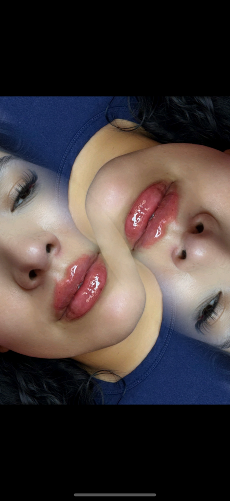 1.5 ML Lip Filler