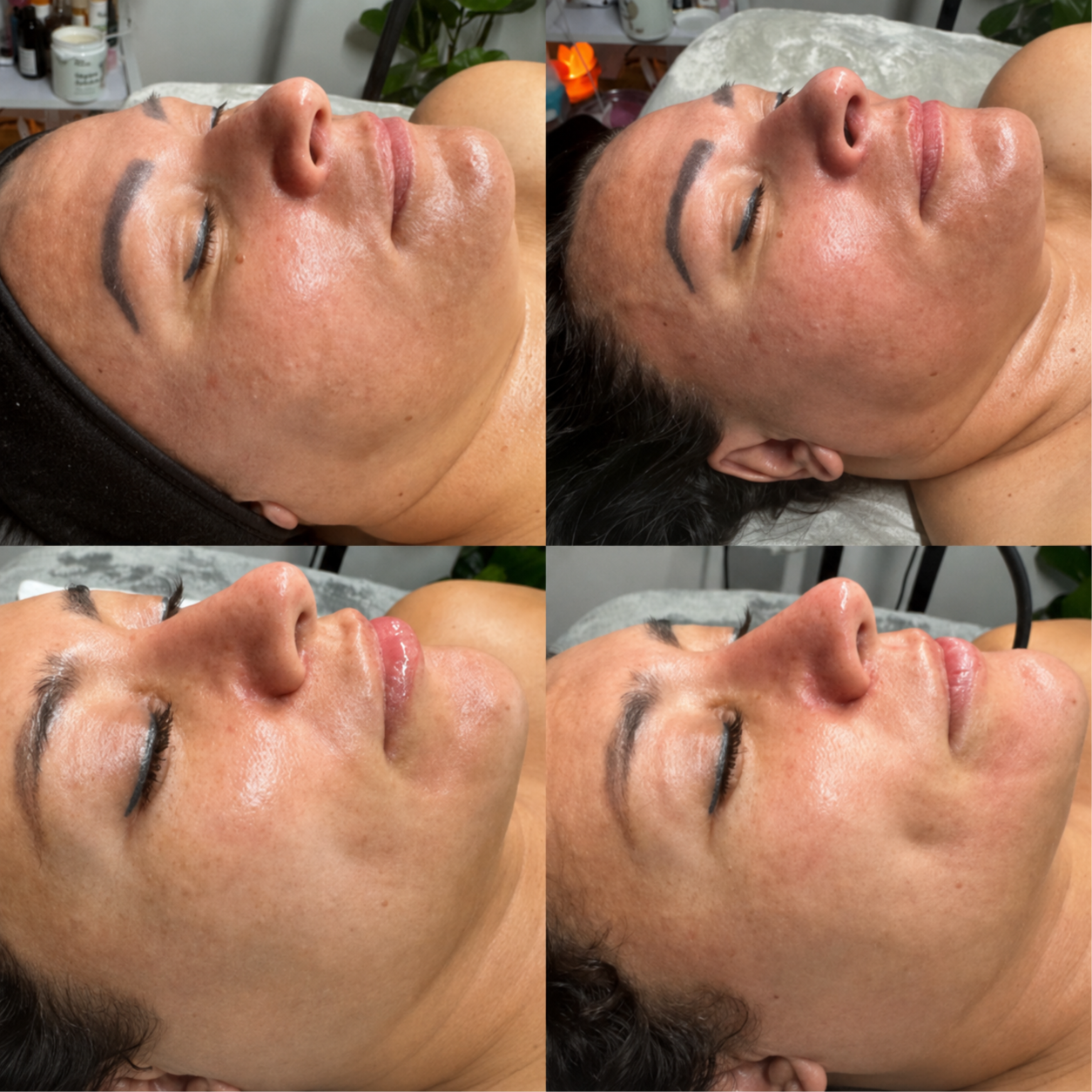 Bye Double Chin at Sculpting Beauty by Pam LLC in Atascocita, TX