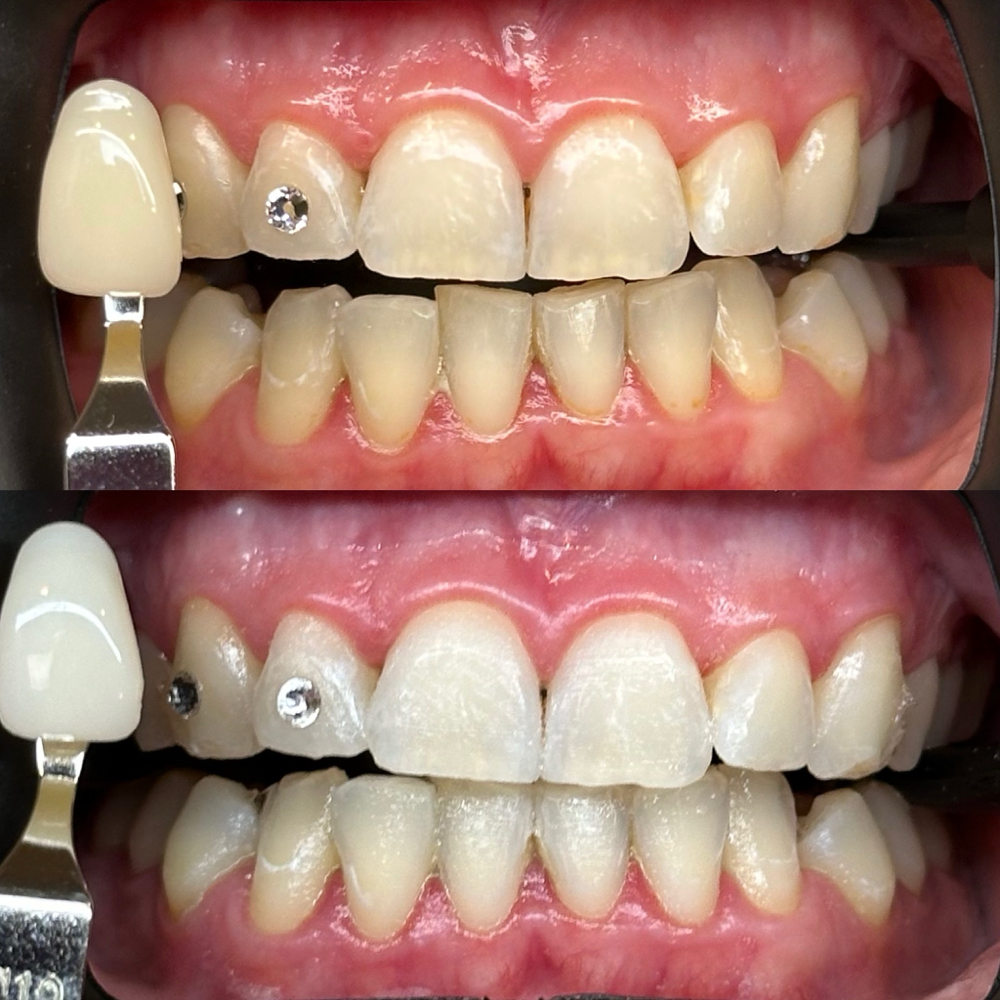 Mother’s Day Whitening at Beauty Lab Los Angeles in Los Angeles, CA