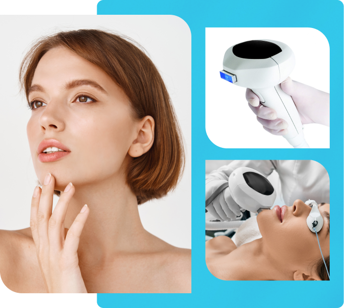 Photo Facial-IPL Lumecca