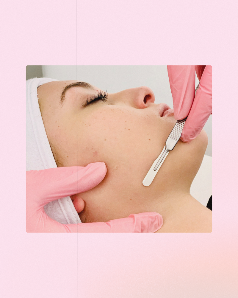 Add-On Dermaplane