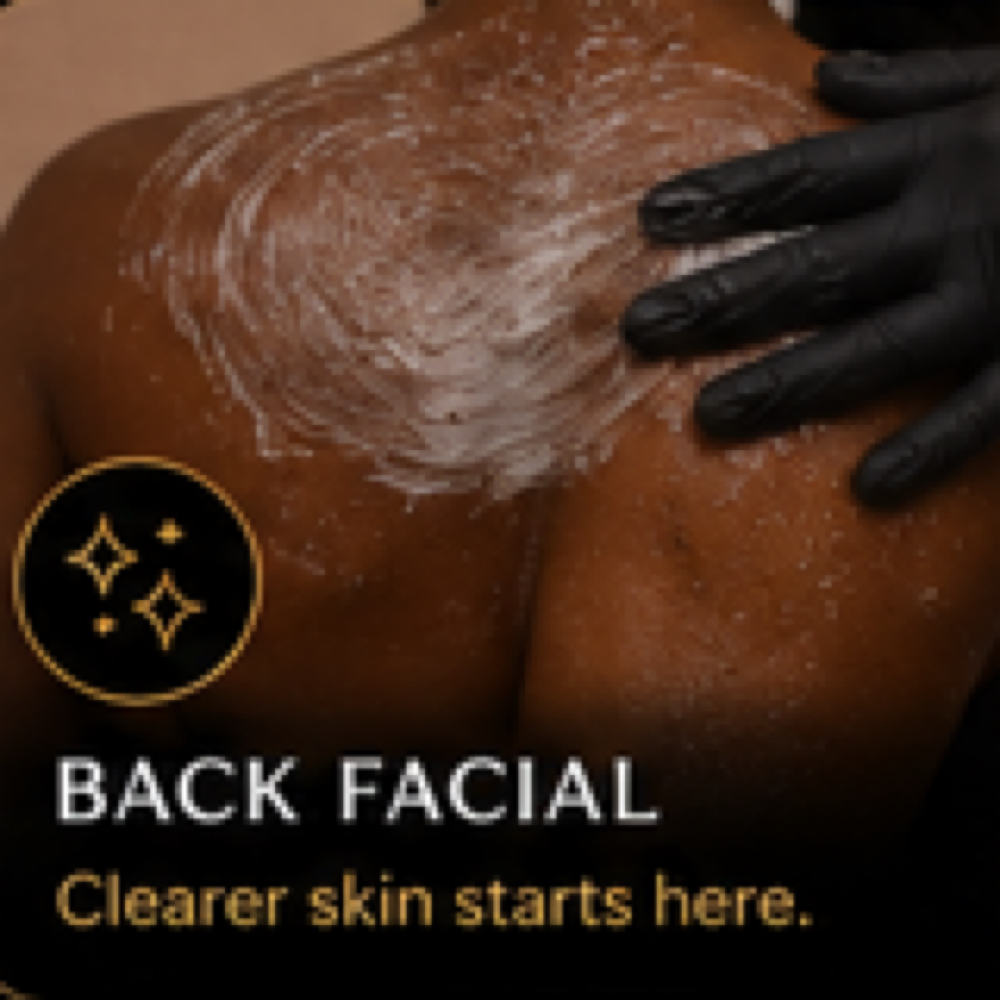 Panela Suga Back Treatment(Bacial) at Mela Suga Wax & Glo in Alexandria, VA