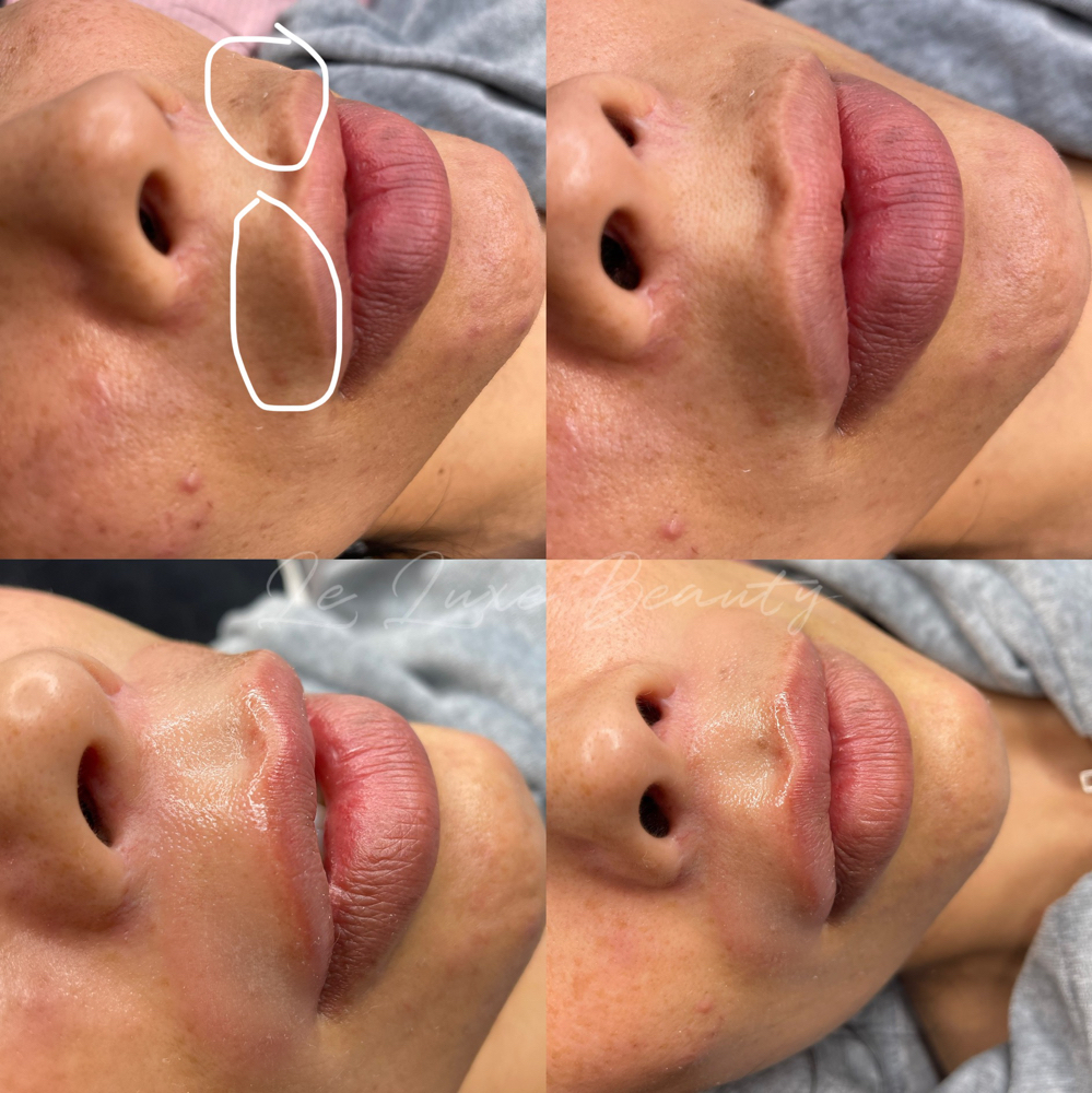 Scar Camoflauge/ Cover Ups at LE LUXE BEAUTY in Los Angeles, CA