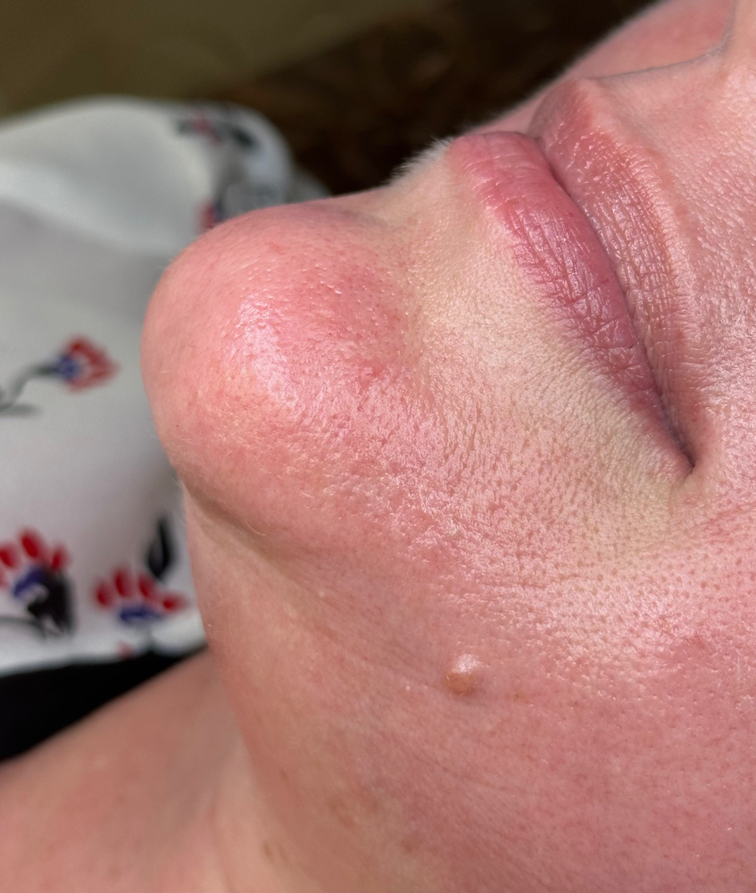 Chin Wax (Female) at Beauty by Madison Rose in Martinsburg, WV