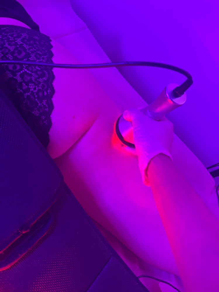 3 Sessions- Cellulite Blaster